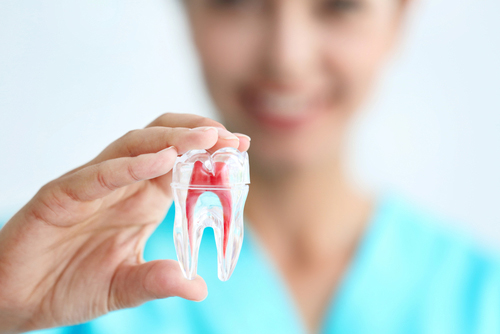 重度の虫歯から歯を残す「根管治療」
